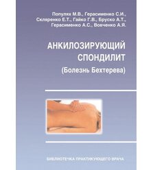 Анкилозирующий спондилит (болезнь Бехтерева)