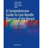 Біопсія молочної залози (Core Needle Biopsies of the Breast)