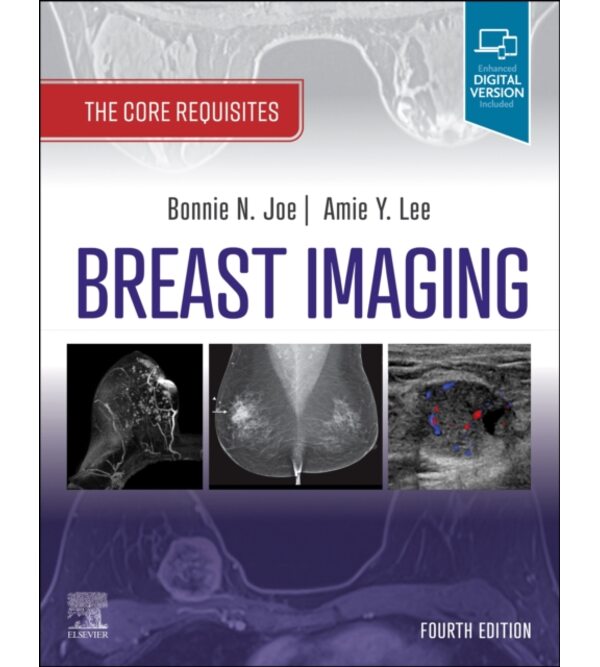 Діагностика захворювань молочної залози (Breast Imaging: The Core Requisites)