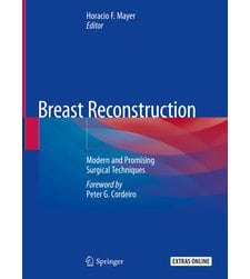 Реконструкція молочної залози: сучасні та перспективні хірургічні методи (Breast Reconstruction)