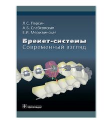 Брекет-системы. Современный взгляд 