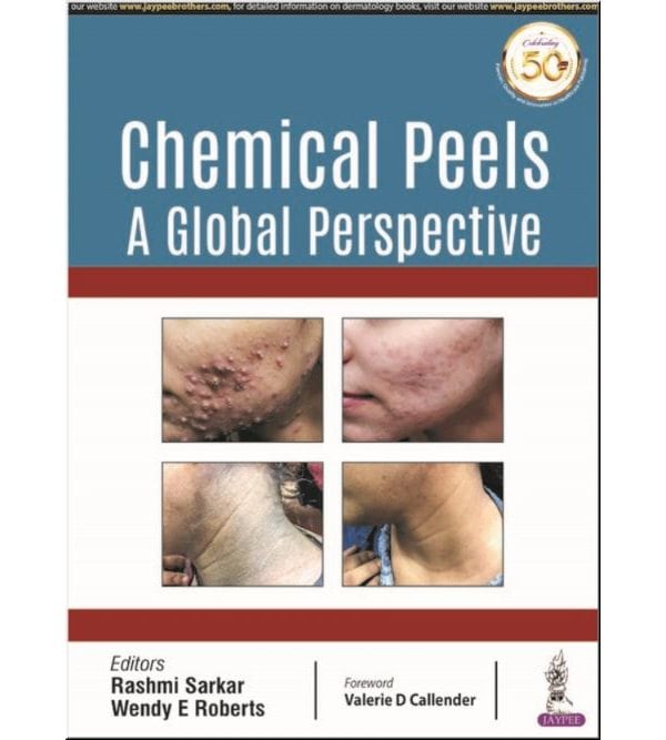 Chemical Peels A Global Perspective
