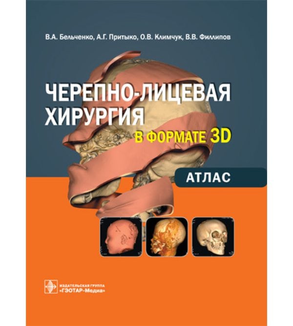 Черепно-лицевая хирургия  в формате 3D