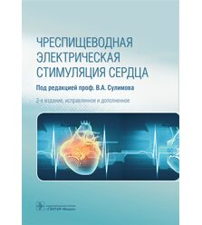 Чреспищеводная электрическая стимуляция сердца
