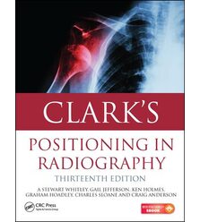Clark's Positioning in Radiography