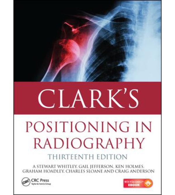 Clark's Positioning in Radiography