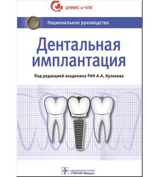 Дентальная имплантация 