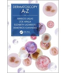 Dermatoscopy A-Z