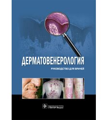 Дерматовенерология : руководство для врачей