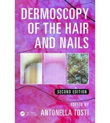 Dermoscopy of the Hair and Nails (Дерматоскопія волосся і нігтів)
