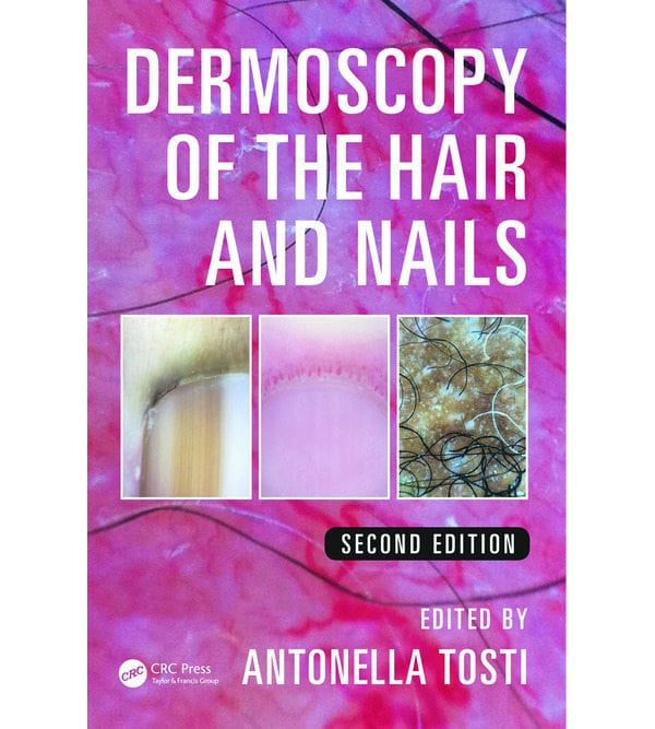 Dermoscopy of the Hair and Nails (Дерматоскопія волосся і нігтів)