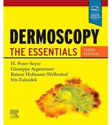 Dermoscopy (Дерматоскопія)