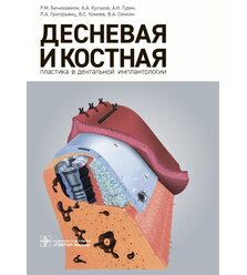 Десневая и костная пластика в дентальной имплантологии 