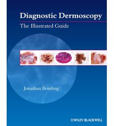 Diagnostic Dermoscopy: The Illustrated Guide