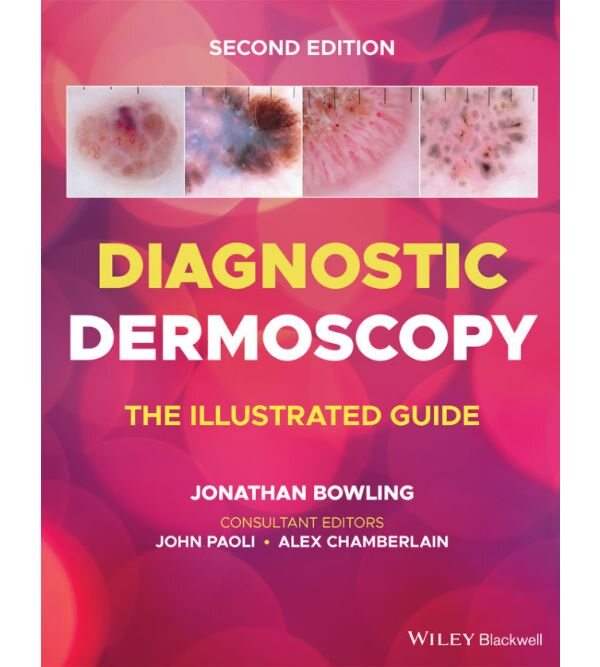 Diagnostic Dermoscopy: The Illustrated Guide