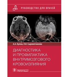 Диагностика и профилактика внутримозгового кровоизлияния: руководство для врачей 