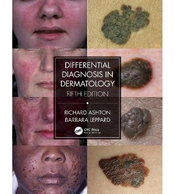 Диференціальна діагностика і лікування в дерматології (Differential Diagnosis and Treatment in Dermatology)