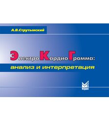 Электрокардиограмма: анализ и интерпретация