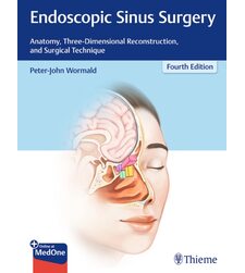Эндоскопическая риносинусохирургия. Анатомия, объемная реконструкция и хирургическая техника