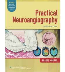 Ендоваскулярна нейрохірургія - Practical Neuroangiography
