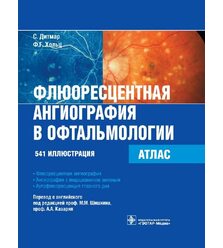Флюоресцентная ангиография в офтальмологии