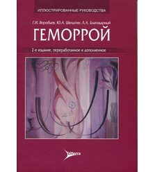 Геморрой