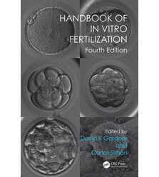 Handbook of In Vitro Fertilization