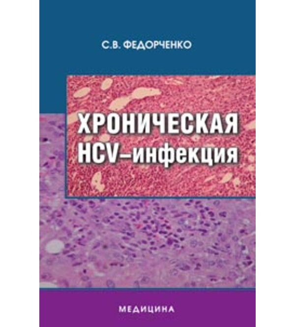 Хроническая HCV-инфекция