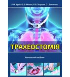 Трахеостомія