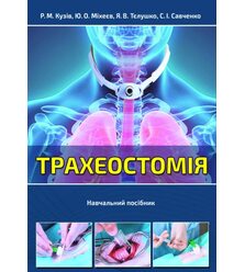 Трахеостомія