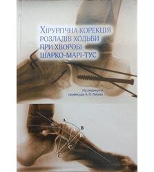 Хірургічна корекція розладів ходьби при хворобі Шарко-Марі-Тус