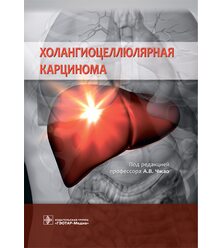 Холангиоцеллюлярная карцинома 