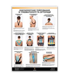Плакат "Кінезіотейпування в травматології та ортопедії"