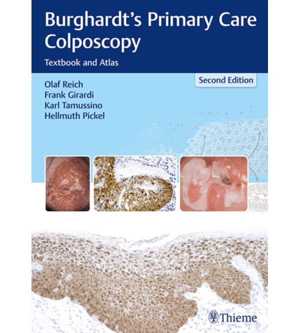 Кольпоскопія и патологія шийки матки по Бургхардту (Burghardt's Primary Care Colposcopy : Textbook and Atlas)