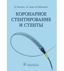 Коронарное стентирование и стенты