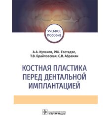 Костная пластика перед дентальной имплантацией