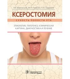 Ксеростомия (сухость полости рта). Этиология, патогенез, клиническая картина, диагностика и лечение 