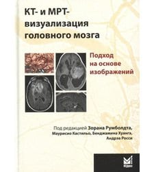КТ- и МРТ- визуализация головного мозга. Подход на основе изображений