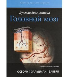 Лучевая диагностика Головной мозг