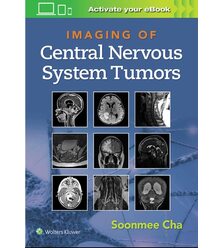 Променева діагностика пухлин ЦНС ( Imaging of Central Nervous System Tumors)