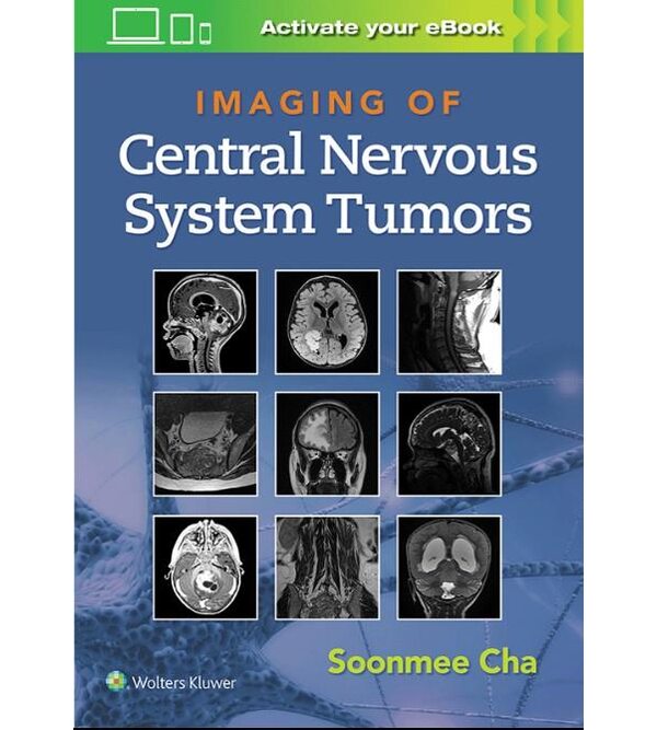 Лучевая диагностика опухолей ЦНС (Imaging of Central Nervous System Tumors)