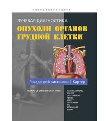 Лучевая диагностика. Опухоли органов грудной клетки