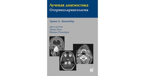 Книга "Лучевая Диагностика. Оториноларингология"