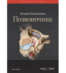 Лучевая диагностика. Позвоночник