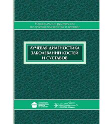Лучевая диагностика заболеваний костей и суставов