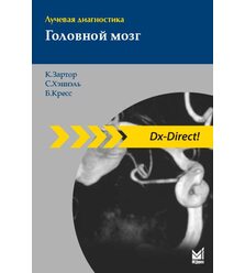 Лучевая диагностика. Головной мозг