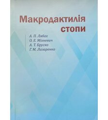 Макродактилія стопи