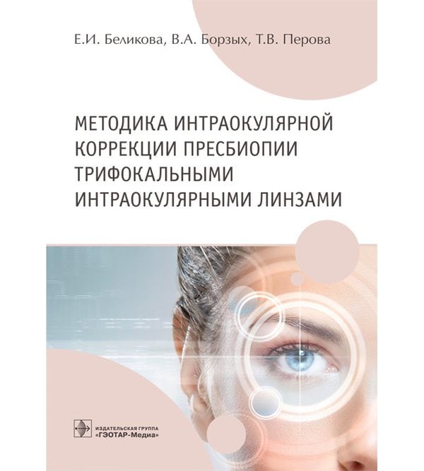 Методика интраокулярной коррекции пресбиопии трифокальными интраокулярными линзами