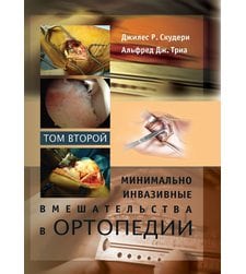 Минимально инвазивные вмешательства в ортопедии: в 2-х томах. Том 2