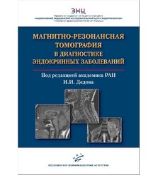 Магнитно-резонансная томография в диагностике эндокринных заболеваний